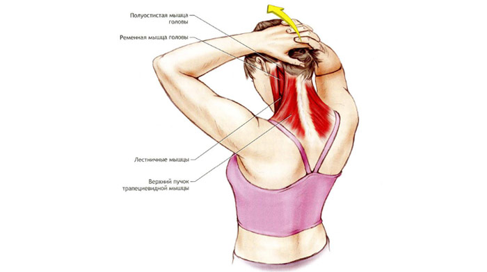 Что делать, если болит шея