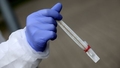 ASV izlūkdienesti atzinuši, ka jaunais koronavīruss nav mākslīgi radīts. Tiek pētīta teorija par negadījumu laboratorijā
